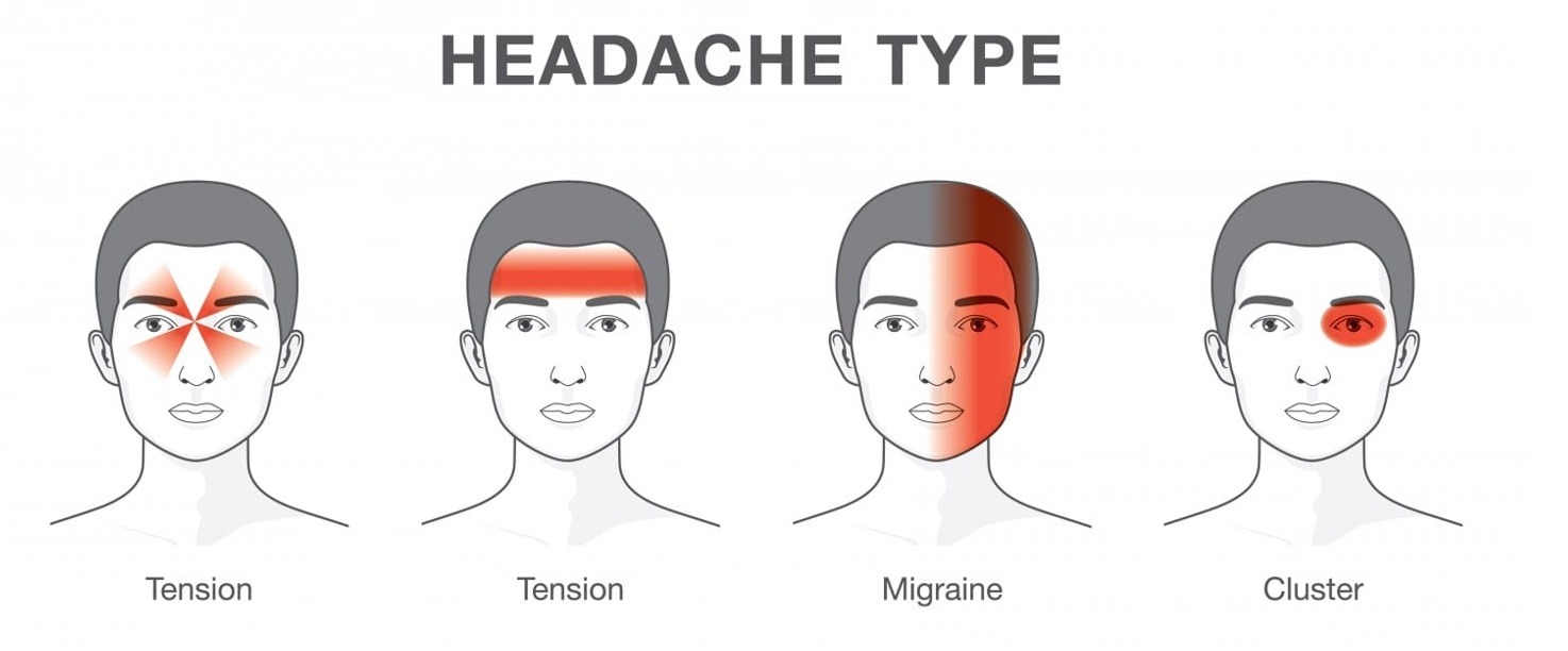 headache type